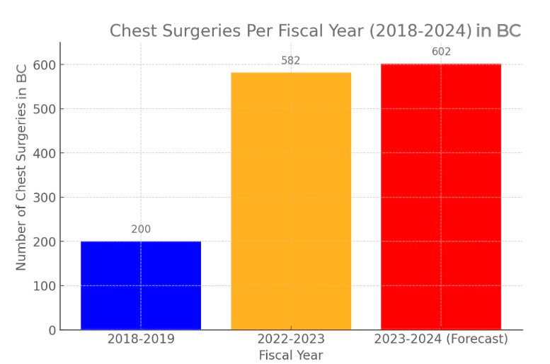 How many women are having top surgery in BC - Breast removal : Chest surgery graph 2018 to 2024 forecast
y-axis showing "Number of Chest Surgeries in BC" (0–600) and the x-axis showing fiscal year. Three bars: 2018–2019 in blue at 200 surgeries, 2022–2023 in orange at 582 surgeries, and 2023–2024 (Forecast) in red at 602 surgeries. The chart shows roughly a threefold increase in chest surgeries between 2018–2019 and 2022–2023, with the 2023–2024 figure being a forecast rather than a final count.
